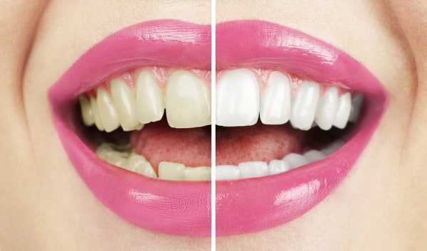 What Early Signs of Oral Cancer Should You Never Ignore Grays?