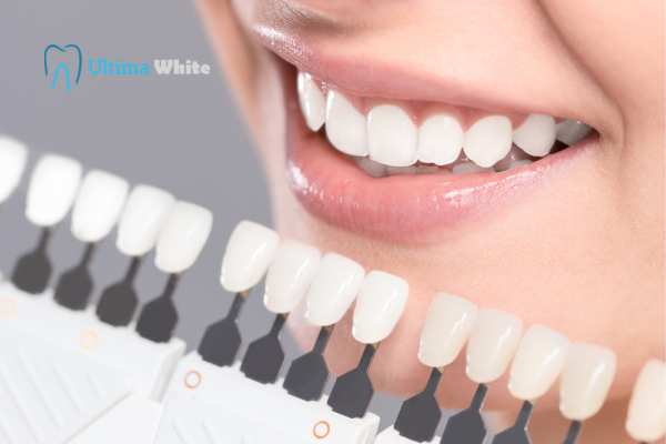 How to Maximise the Results of Your Laser Teeth Whitening Treatment Grays