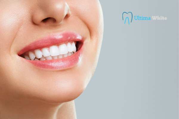 Common Mistakes That Can Ruin Your Whitening Results Grays