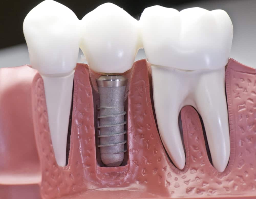 Common Misconceptions About Modern Dental Treatments Grays
