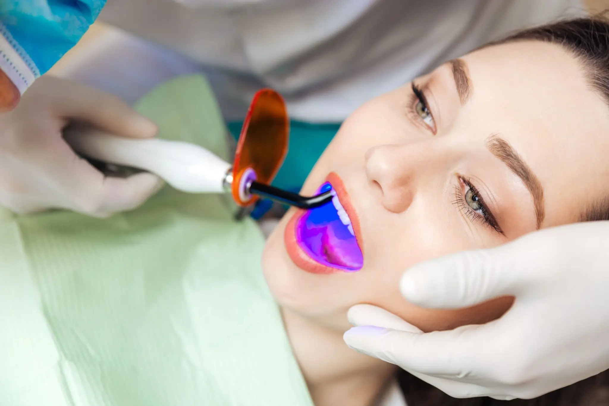 Common Risks of Whitening Without Expert Dental Guidance Grays