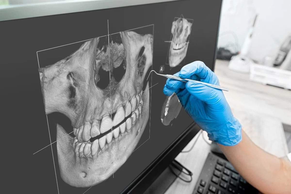 How Is AI Transforming Dental Treatment Planning Grays?