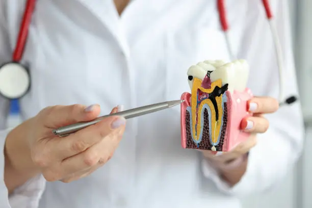 The Silent Culprits: Common Habits That Damage Your Teeth Grays