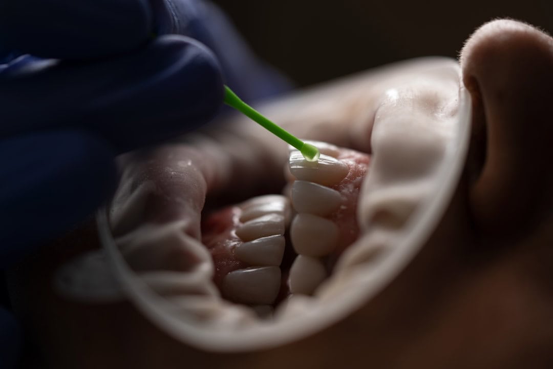 How Saliva Protects Your Teeth and Gums Grays