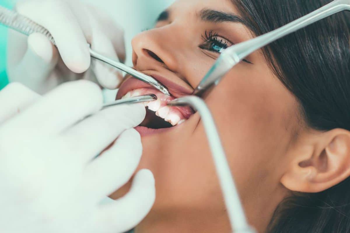 Can Laser Whitening Damage Your Enamel or Cause Long-Term Harm Grays?