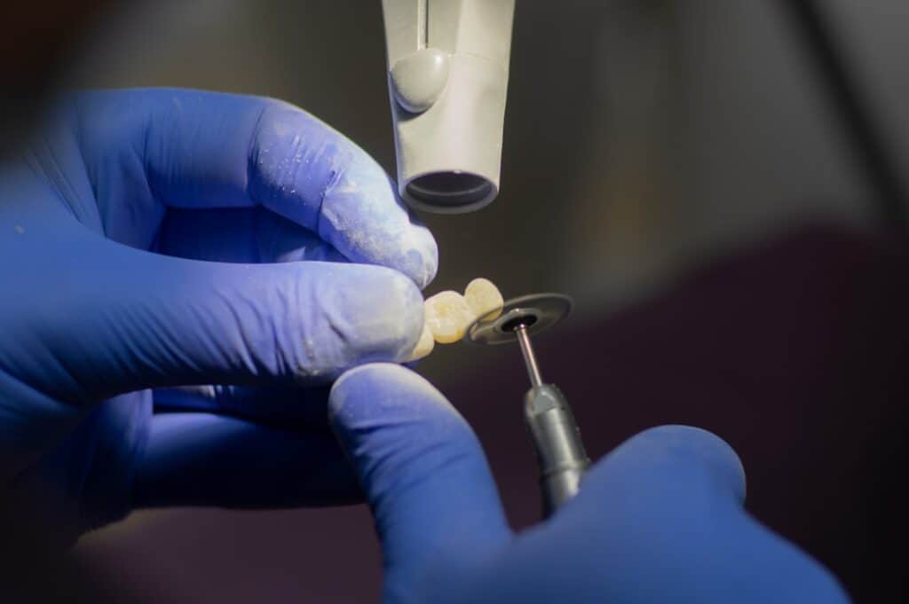 Customised Dental Solutions: Crowns, Aligners, and Implants Grays