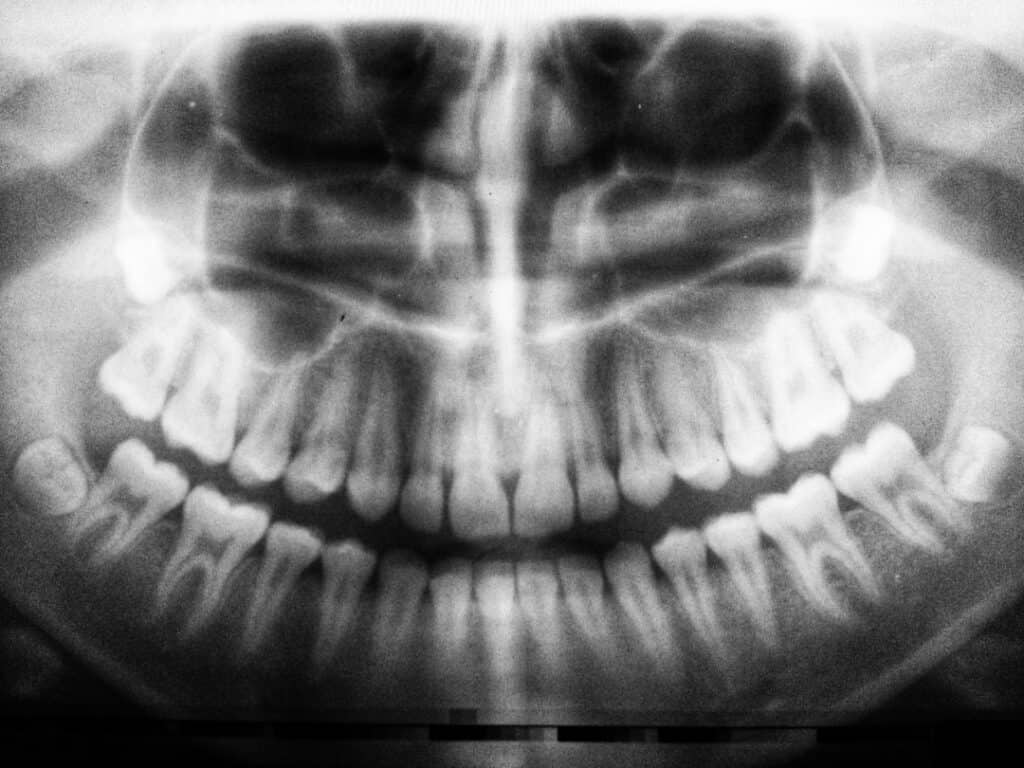 The Future of 3D Printing in Oral Healthcare Grays